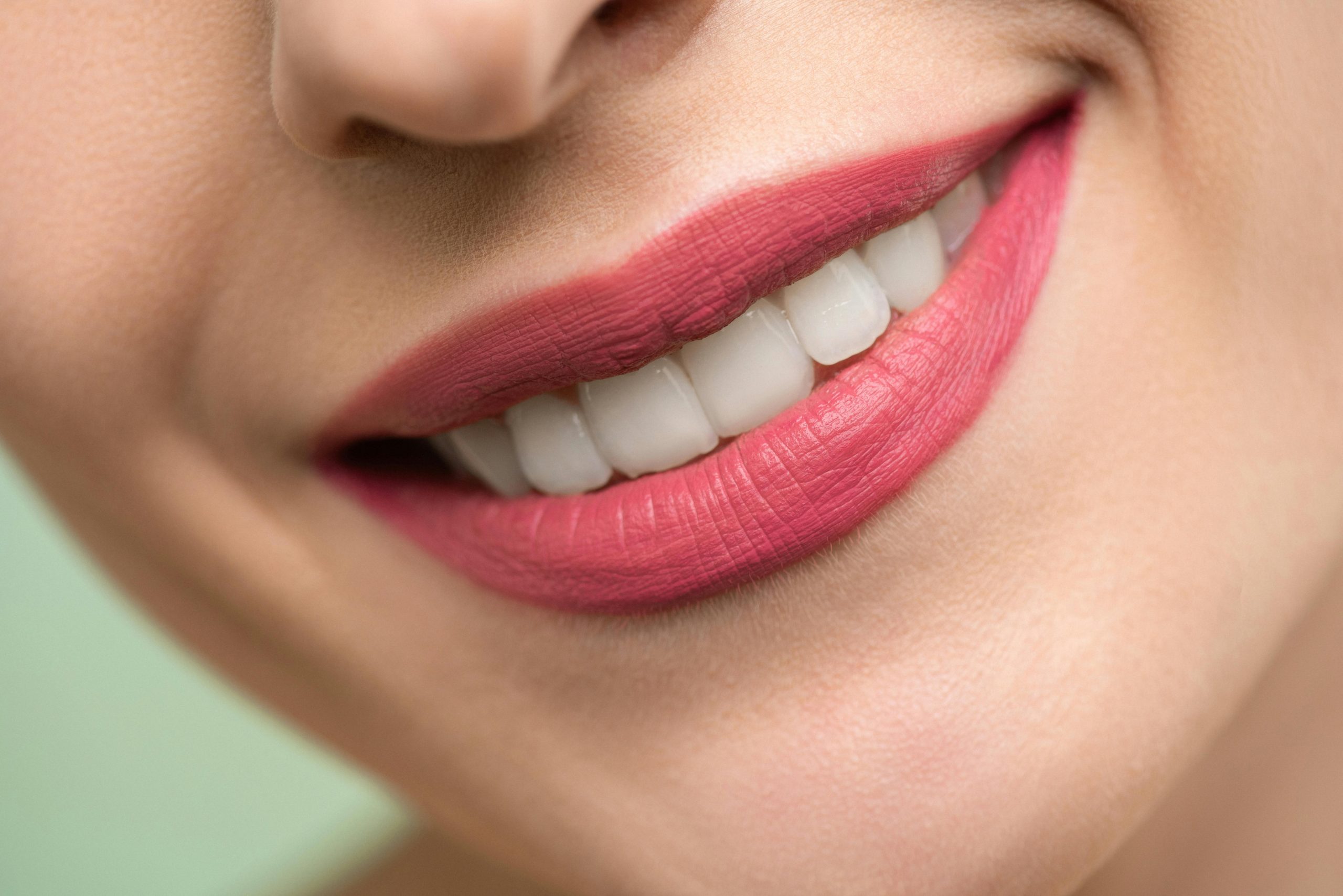 close-up of well-aligned, white teeth