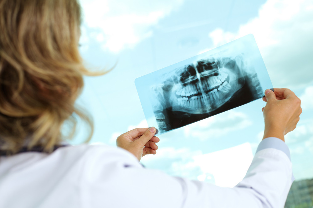 what to expect after dental implant