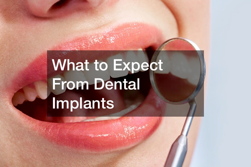 What to Expect From Dental Implants