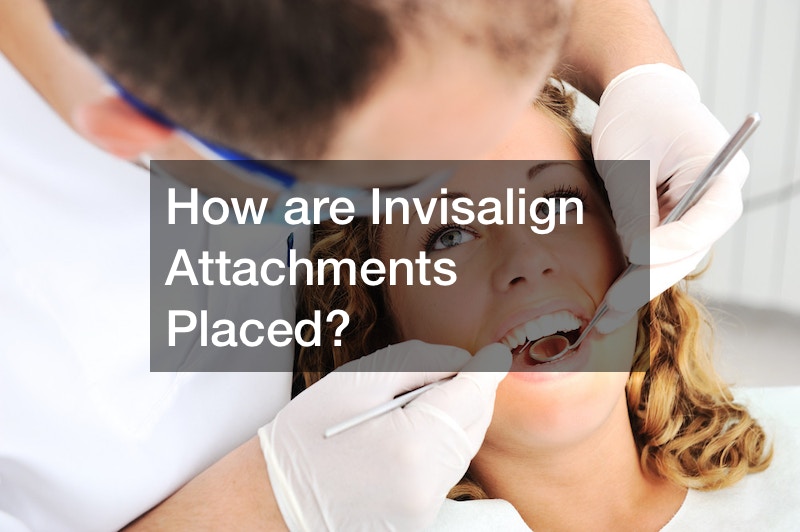 How are Invisalign Attachments Placed?