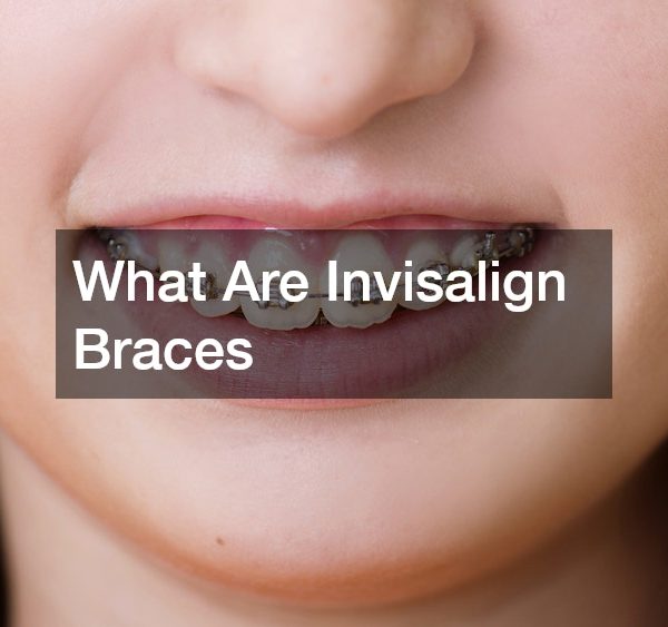 What Are Invisalign Braces