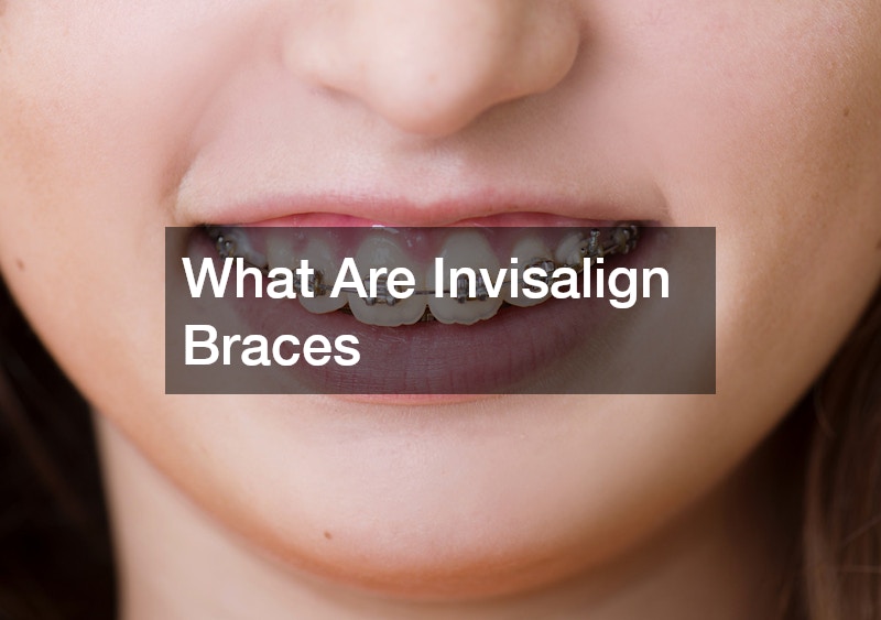 What Are Invisalign Braces