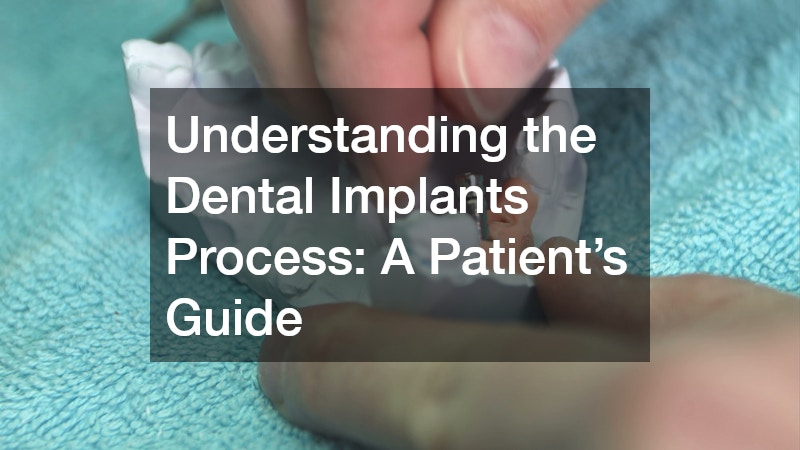 Understanding the Dental Implants Process A Patient’s Guide