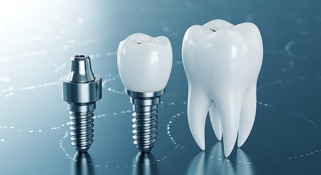 What Are the 3 Types of Dental Implants and Which One Is Right for You?