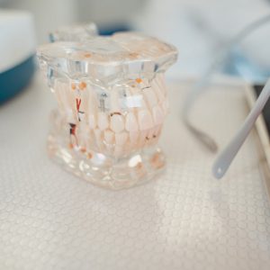 dental implant model