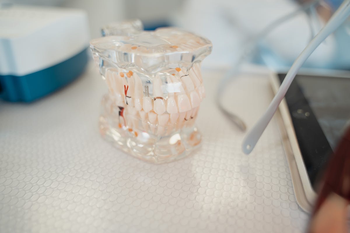 dental implant model